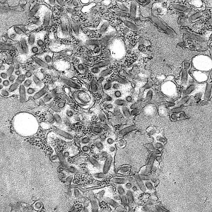 Micrograph photo of rabies virus